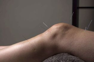 Acupuncture promotes the regeneration of joint tissue