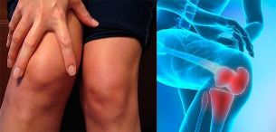 Anxiety and swelling in the knee area are the first signs of osteoarthritis